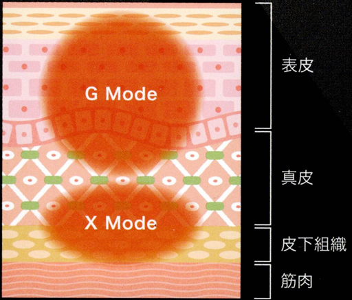 独自のGXGトリートメント方式